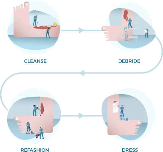 Ilustracja przedstawiająca kluczowe etapy Higieny Rany: mycie, oczyszczanie, pielęgnacja brzegów rany i dobór opatrunku